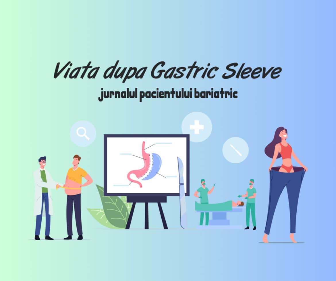 Viața după Gastric Sleeve – jurnalul pacientului bariatric după operația de micșorare a stomacului