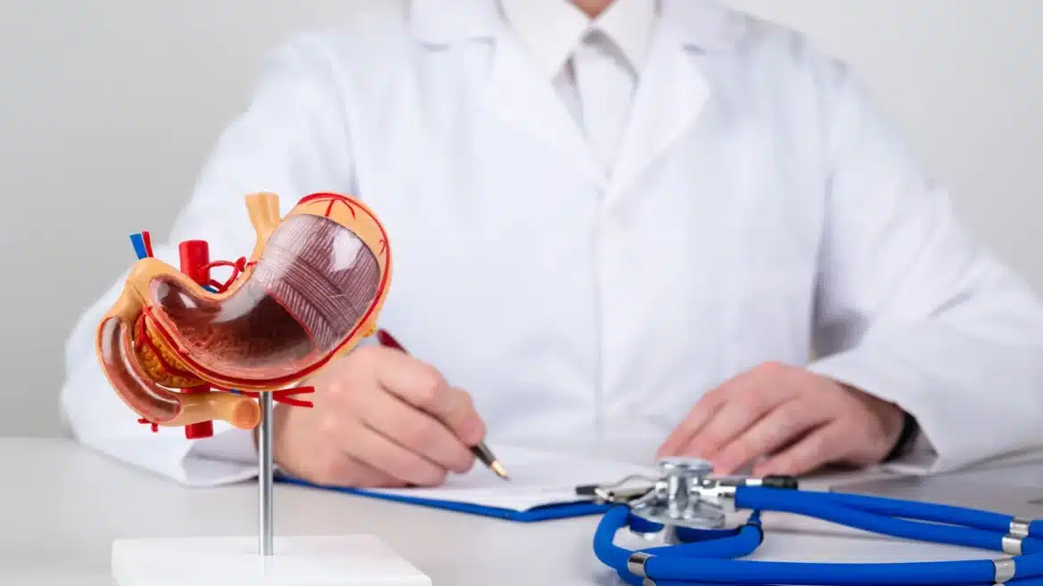 Model anatomic al stomacului utilizat pentru explicarea operației de gastric sleeve