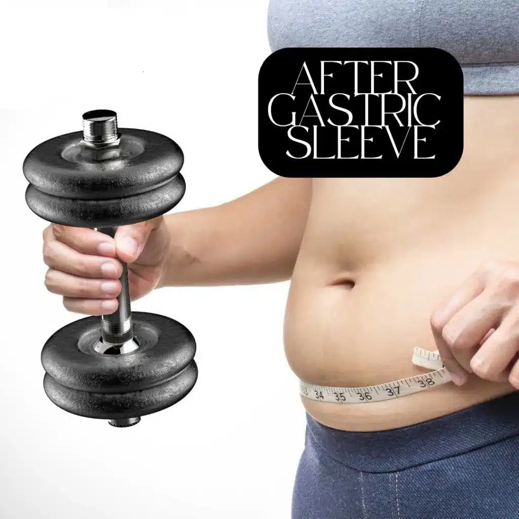 Persoană care măsoară circumferința abdomenului după gastric sleeve