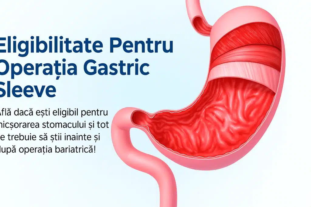 Ilustrație medicală care explică eligibilitatea pentru operația de micșorare a stomacului (Gastric Sleeve).