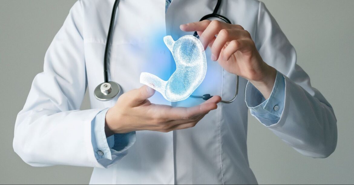 Chirurg care ține în mână o reprezentare 3D a stomacului – simbol al chirurgiei bariatrice