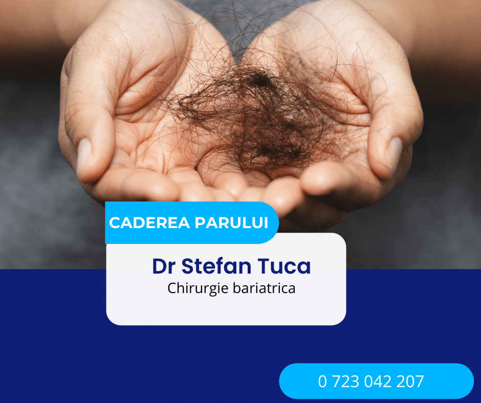 Căderea părului după gastric sleeve – smoc de păr în mâini, utilizat în articolul Dr. Ștefan Tucă despre efectele temporare după chirurgia bariatrică.