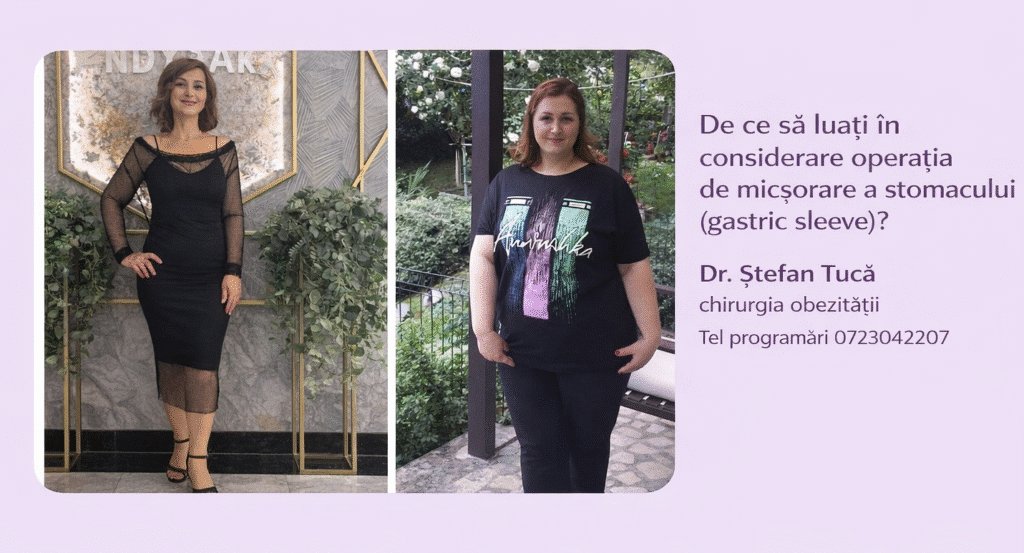 Rezultat real înainte și după operația de micșorare a stomacului (gastric sleeve), pacientă tratată de Dr. Ștefan Tucă, cu scădere semnificativă în greutate