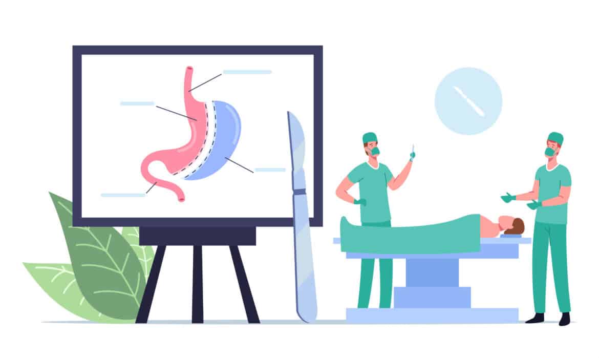 Intervenție chirurgicală bariatrică Gastric Sleeve – micșorarea stomacului laparoscopic