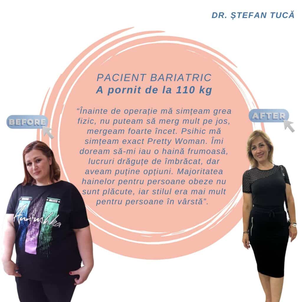 rezultate Gastric Sleeve